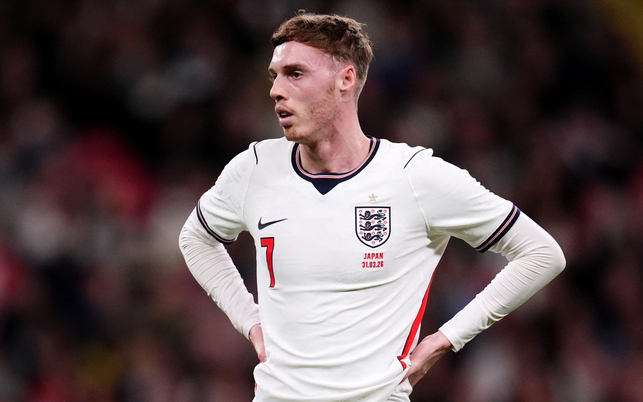 Cole Palmer Injury: What It Means for Tuchel